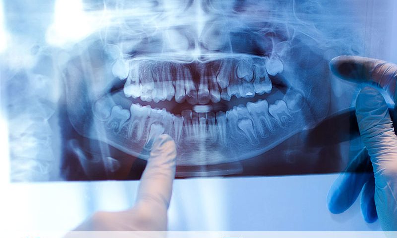 dental görüntüleme